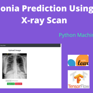 Pneumonia Prediction Using chest x-ray