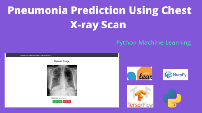 Pneumonia Prediction Using chest x-ray
